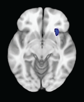 Photo of  the anterior insula region of the brain