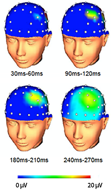 Graphic: Cortical excitation following TMS stimulation