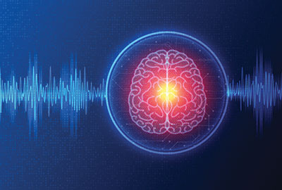 Abstract Illustration of a brain undergoing neurostimulation
