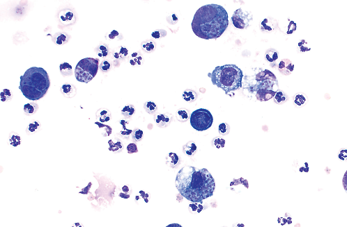 Photo shows Toxoplasma gondii parasites