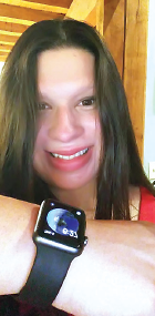 Photo: Allison Dailey, M.D. wearing an Apple Watch