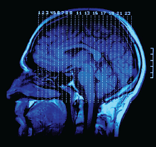 Photo: Brain x-ray