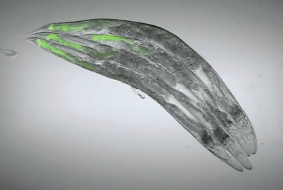 Photo: guts of C. elegans