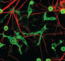 Photo: Microglia and Neurons