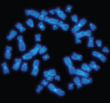 Photo: Chromosomes in Brain Cells