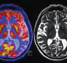 Photo: MRI images