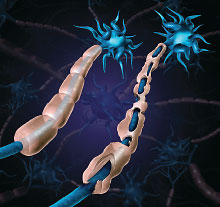 Graphic: Neurons Membranes