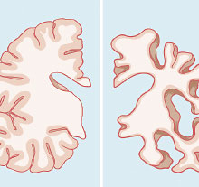Graphic: brain sections