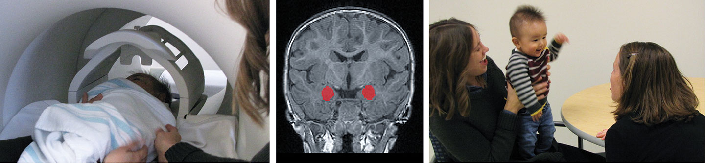 Photo: Left: Six-month-old baby asleep during MRI scan, alongside mother and UNC researcher. Middle: The amygdala (in red) grows too rapidly in the first year of life in babies who later develop autism. Right: Baby during a test of social skills.