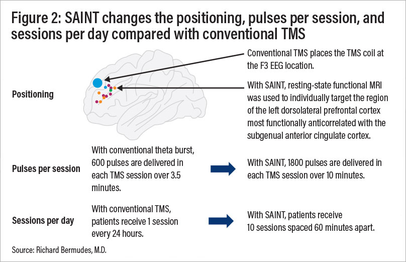 Figure 2: SAINT changes the positioning, pulse per session, and sessions per day compared with conventional TMS