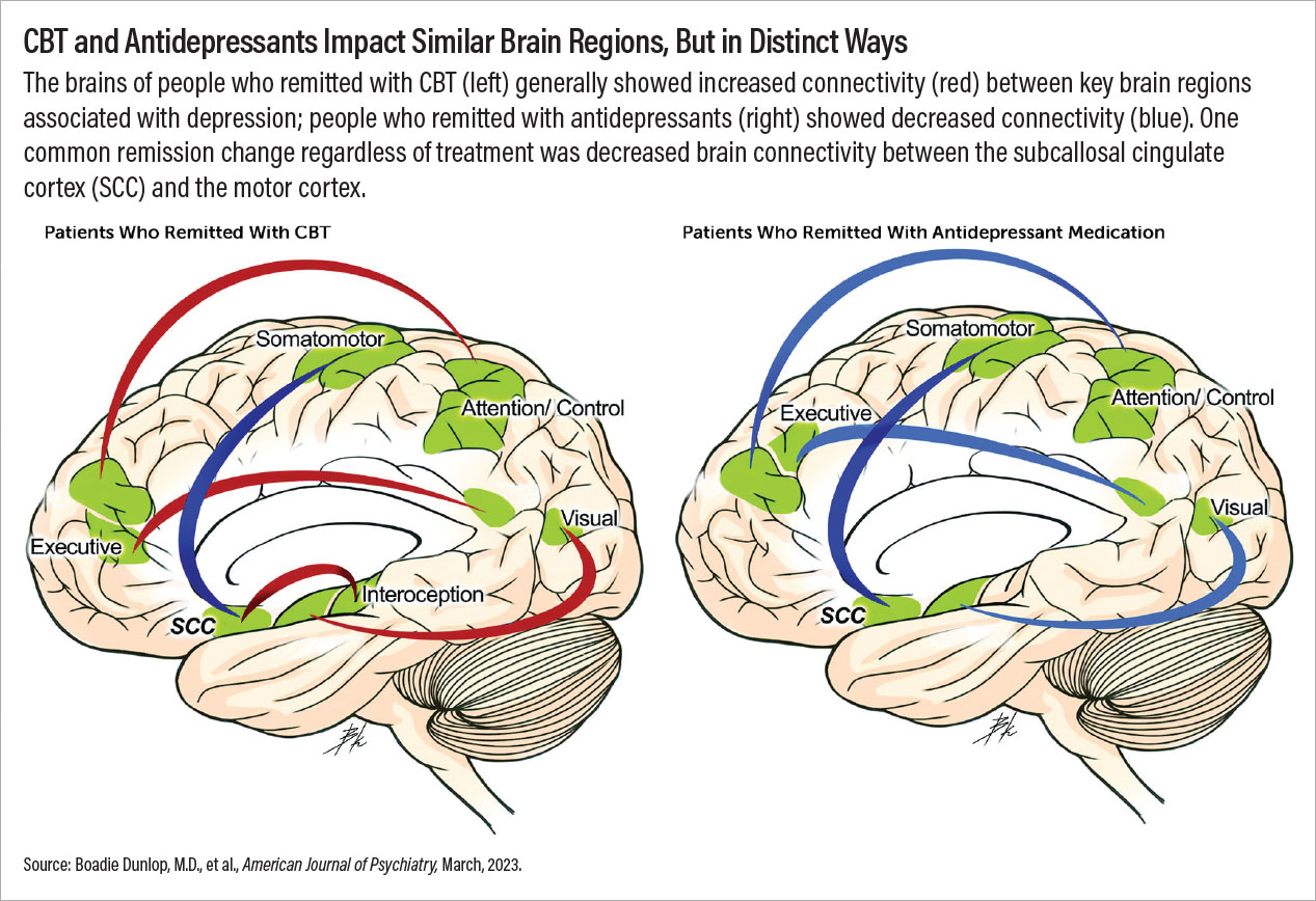 The brains of people who remitted with CBT (left) generally showed increased connectivity (red) between key brain regions associated with depression; people who remitted with antidepressants (right) showed decreased connectivity (blue). One common remission change regardless of treatment was decreased brain connectivity between the subcallosal cingulate cortex (SCC) and the motor cortex.