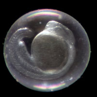 Photo of a zebrafish embryo