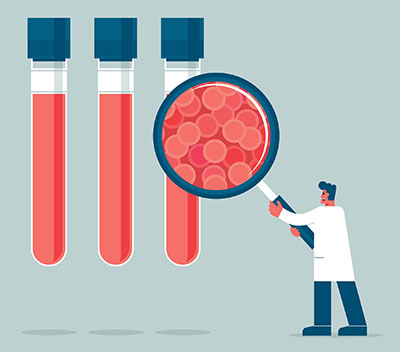 Illustration of a lab technician examining large vials of blood with a large magnifying glass.